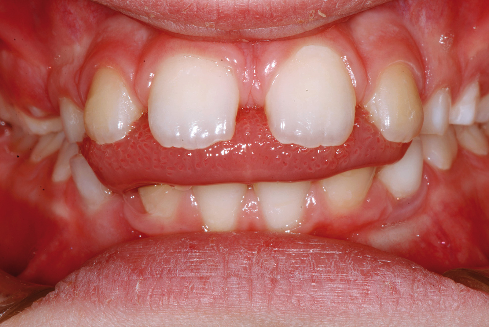 DM_2015_001_montaruli001